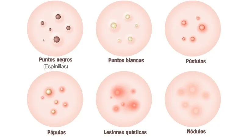 lesiones inflamatorias en la piel